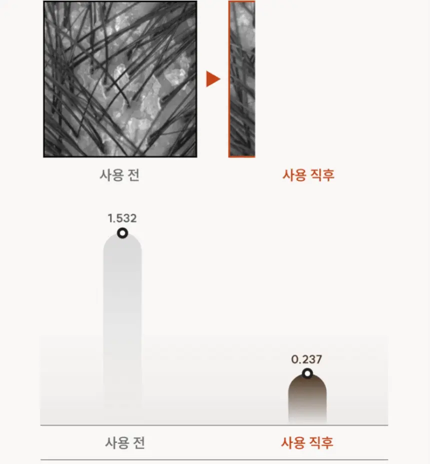 [1등 두피세럼 / 특허 맥주효모] 나인밀라 맥주효모 두피영양제 앰플 팩 120ml 단독 기획 (+샴푸 60ml 증정) 상세페이지 13